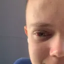 EyE7