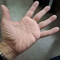 Spina