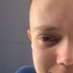EyE7